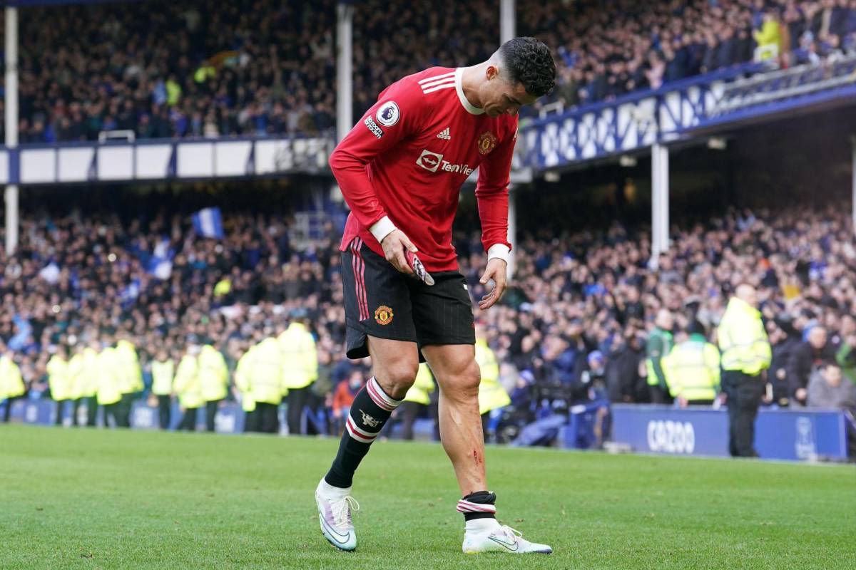 Escalofriante: así le quedó la pierna a Cristiano Ronaldo en la dolorosa derrota del Manchester United