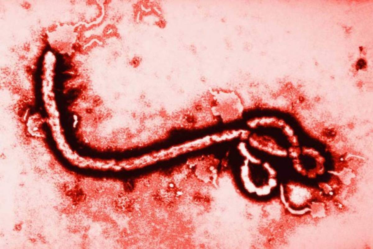 ¡Transmitidos por ratas, monos y aves! Estos son los 10 virus más letales en el mundo