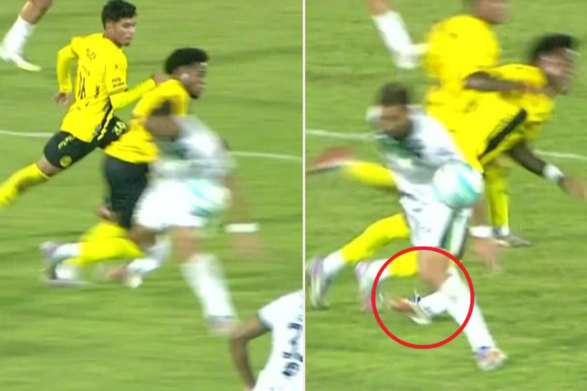 Exon Arzú chocó contra Fabricio Silva y el uruguayo se fracturó la tibia y peroné.