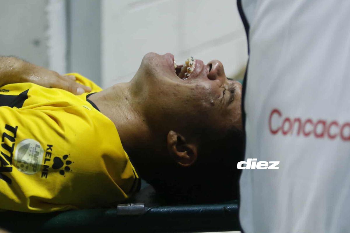 Real España sufrió importante baja en su primer triunfo en Copa Centroamericana; linda chica enamoró en el Morazán