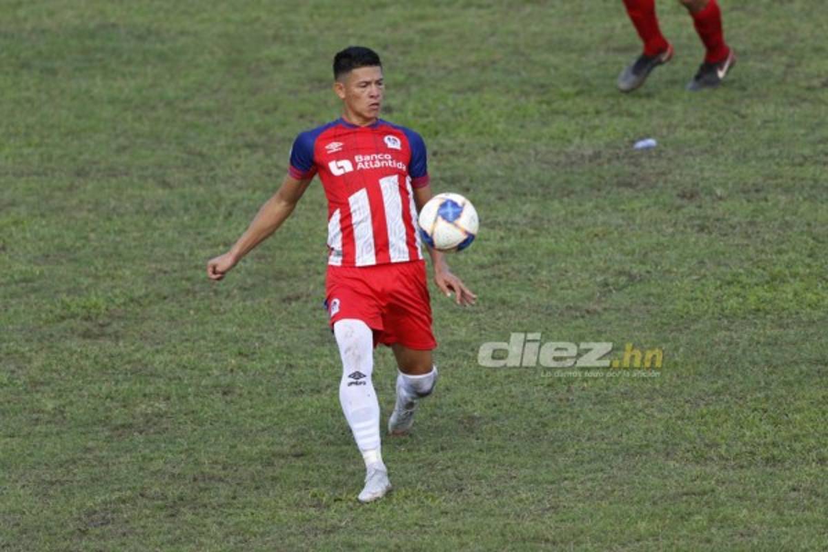 El 11 con que Olimpia buscará sorprender a Thierry Henry y su Montreal Impact