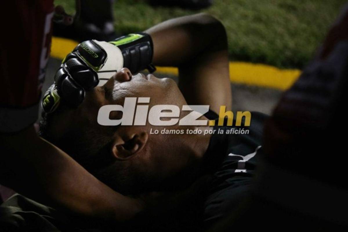 ¡QUÉ DRAMÁTICO! La espeluznante lesión de Donis Escober