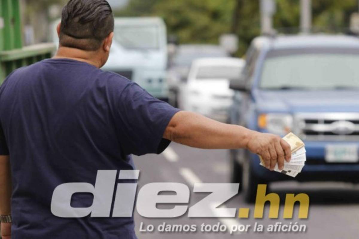 ¡Ufff! Eddie Hernández se quita la máscara y así se ve su ojo; ambiente en Honduras se calienta