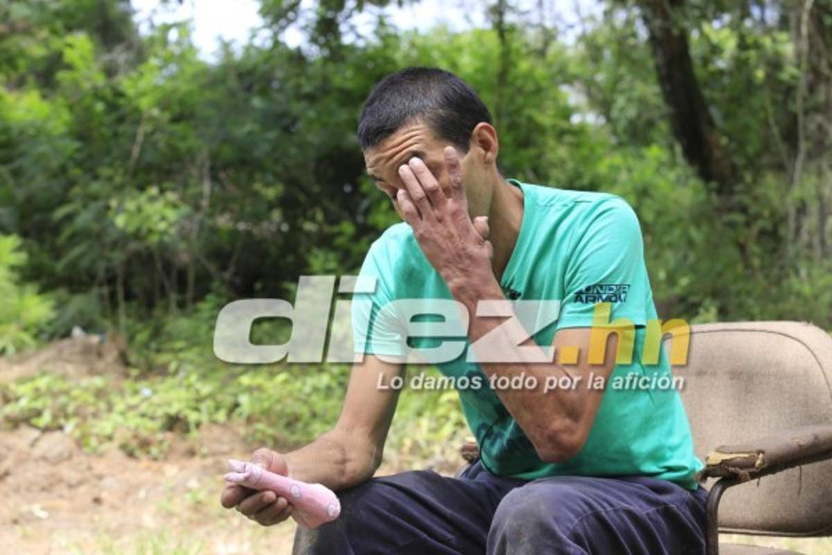 FOTOS: Óscar Lagos, un futbolista golpeado duramente por las drogas