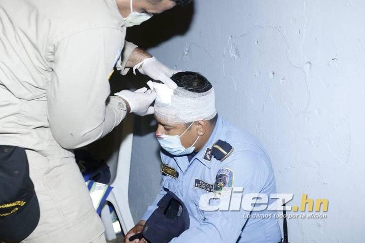 Joven cayó de espaldas al suelo: las otras fotos que no viste del zafarrancho del Real España-Marathón ¡varios policías heridos!