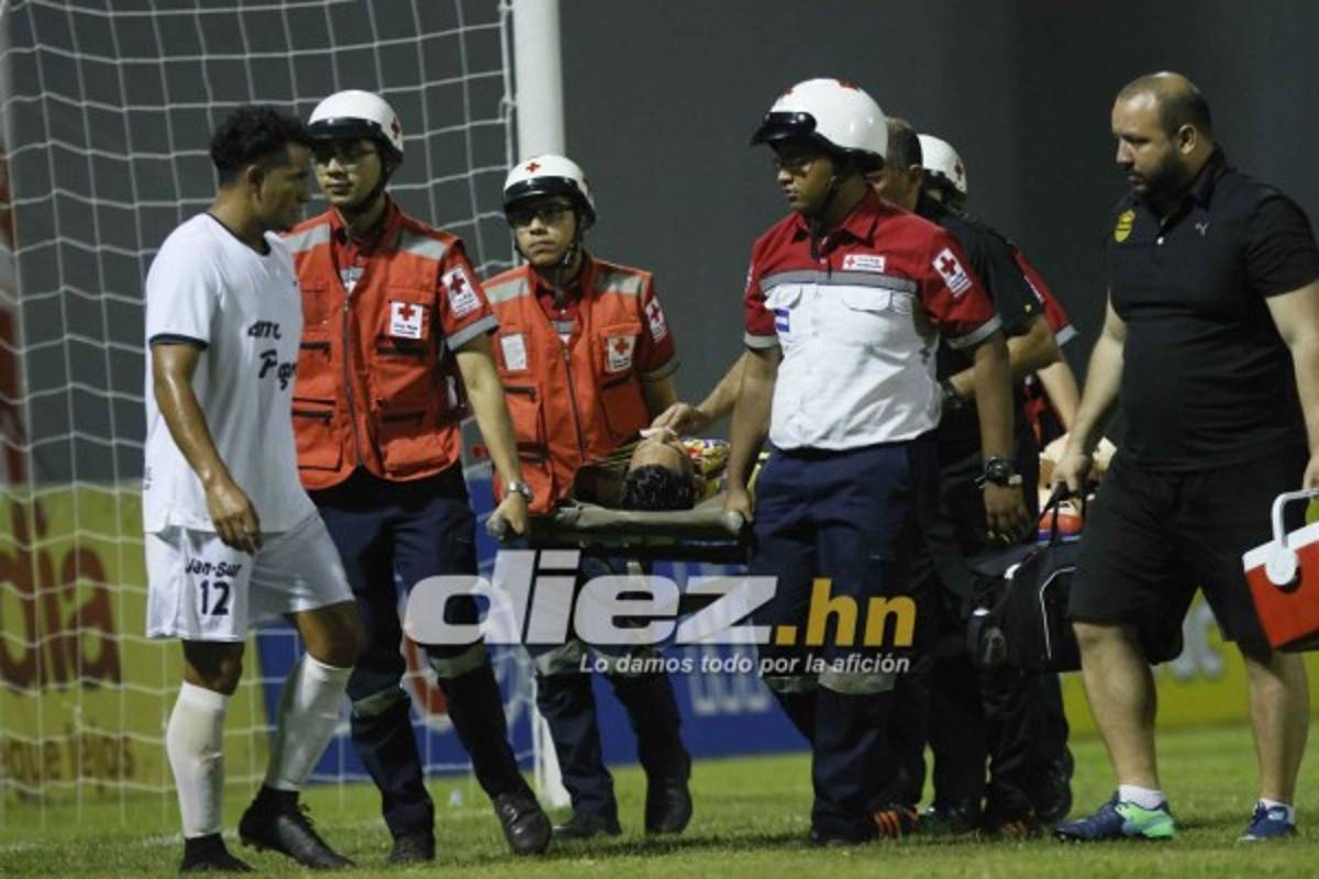 CURIOSAS: El 'nocaut' a Allans Vargas y el agarrón de pelo de César Oseguera a Yeer