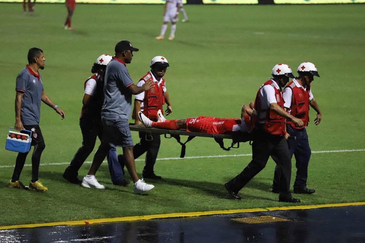 Tremendo diluvio en el Nacional, enfado de los aficionados de Marathón, jugador en muletas, bellas chicas y DT en aprietos