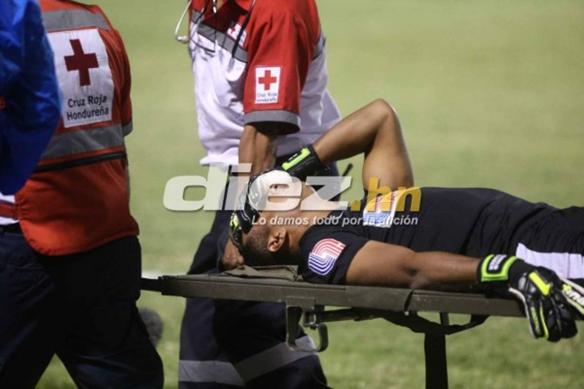 ¡QUÉ DRAMÁTICO! La espeluznante lesión de Donis Escober