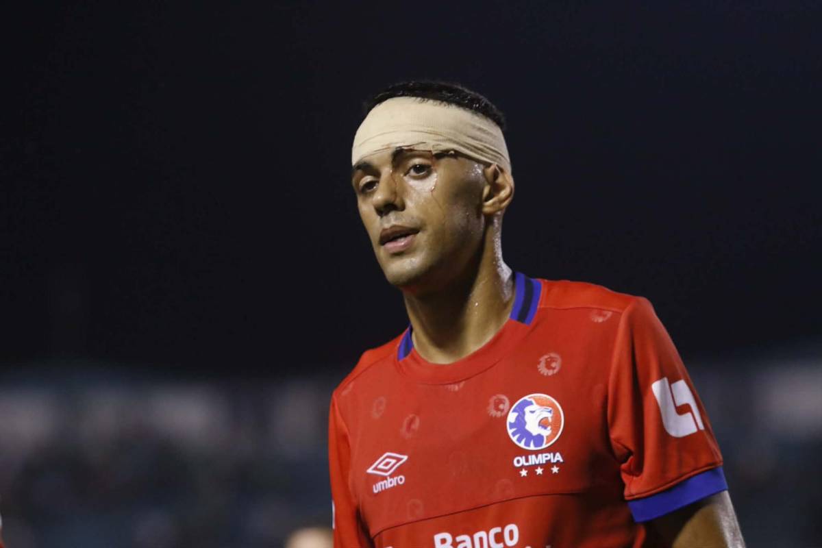 La red de la polémica, sangre en la final Marathón vs Olimpia, estilo Bielsa y el besito que conmovió