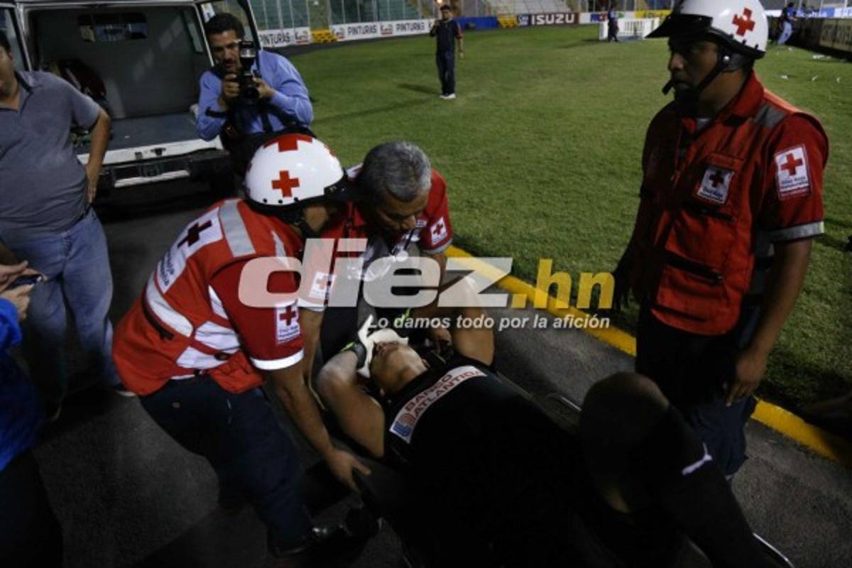 ¡QUÉ DRAMÁTICO! La espeluznante lesión de Donis Escober