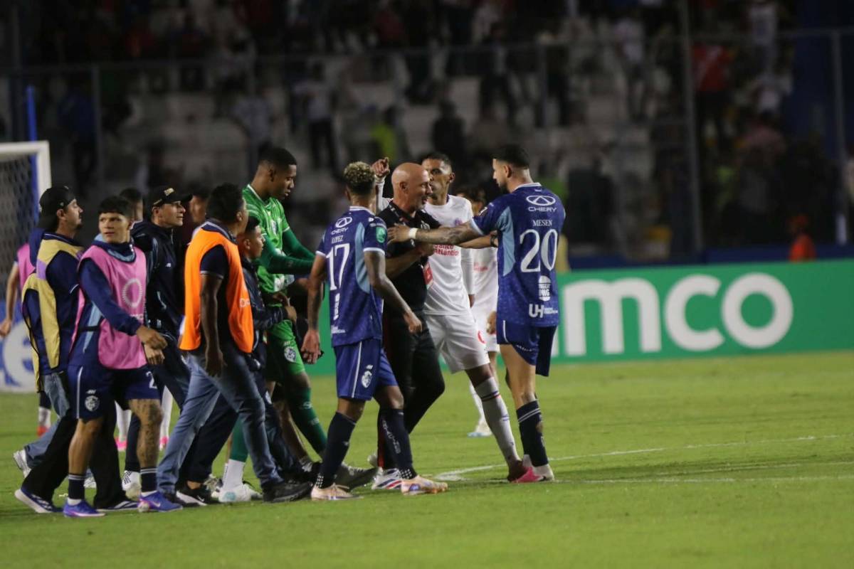 La desgarrada imagen de Bennett, otro error de Menjívar y las leyendas