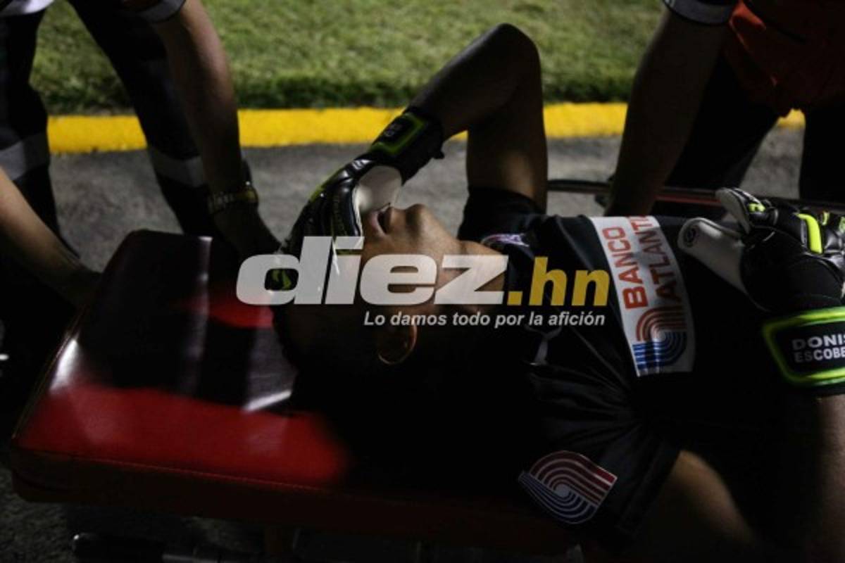 ¡QUÉ DRAMÁTICO! La espeluznante lesión de Donis Escober