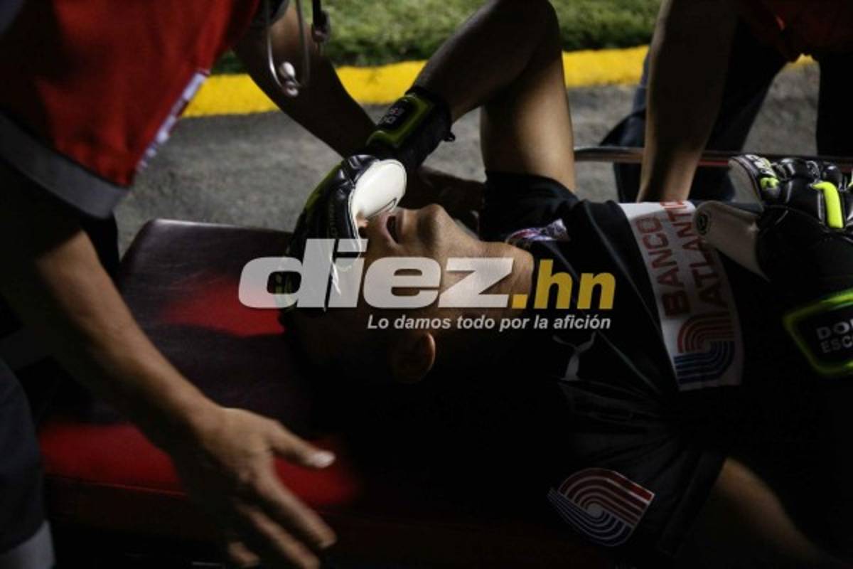 ¡QUÉ DRAMÁTICO! La espeluznante lesión de Donis Escober