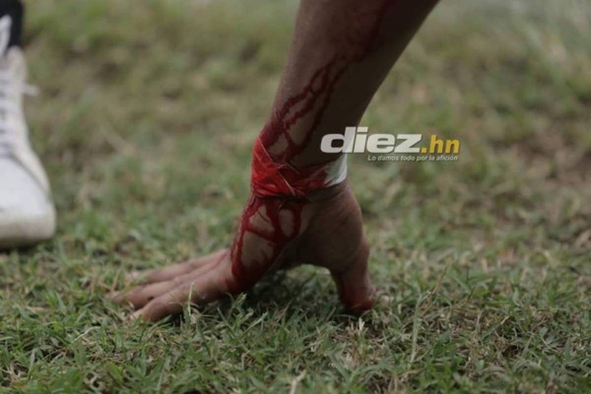 NO VISTE EN TV: Sangre, lágrimas y festejos en la vuelta del repechaje en el Yankel