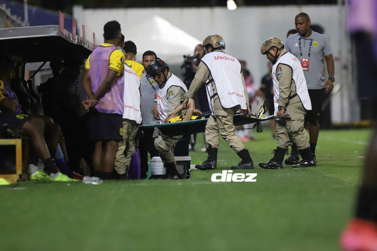 Real España sufrió importante baja en su primer triunfo en Copa Centroamericana; linda chica enamoró en el Morazán