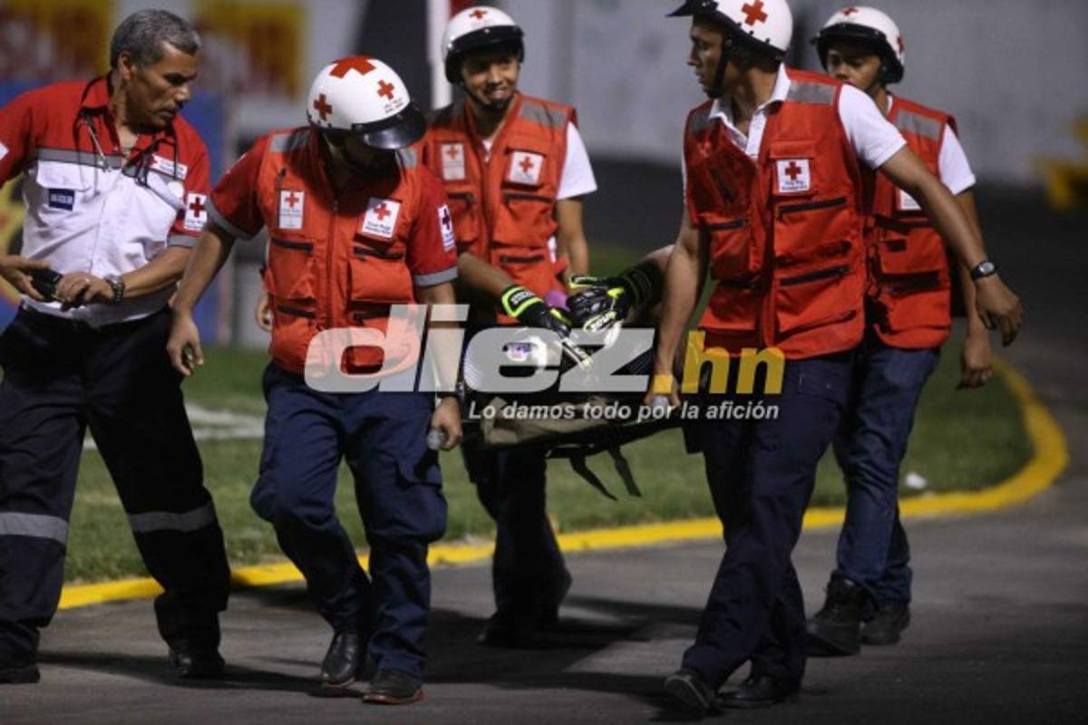 ¡QUÉ DRAMÁTICO! La espeluznante lesión de Donis Escober