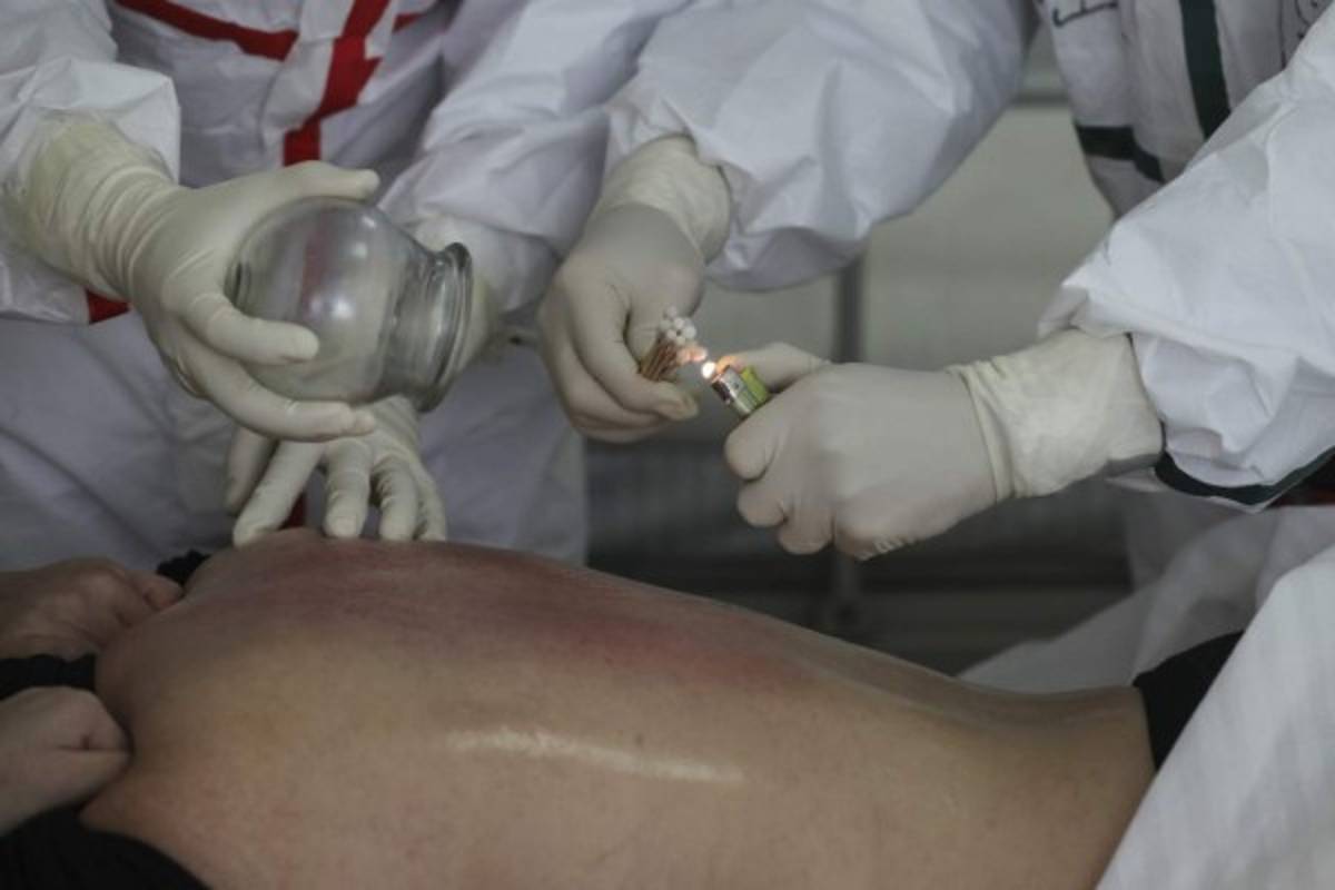 Las técnicas ancestrales que utilizan los médicos chinos para eliminar el coronavirus