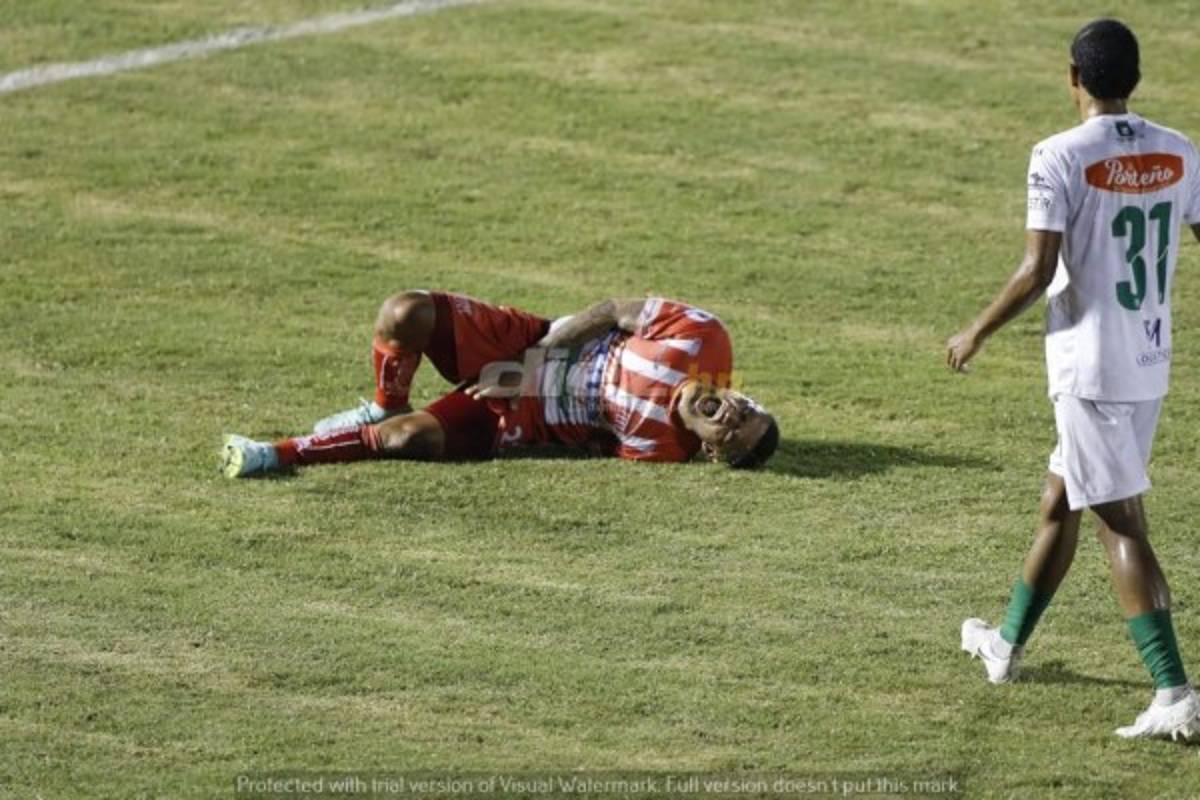 ¡No se vio en TV! El enorme beso de Chavasco; la belleza que eclipsó La Ceiba y la furia de Jorge Cardona