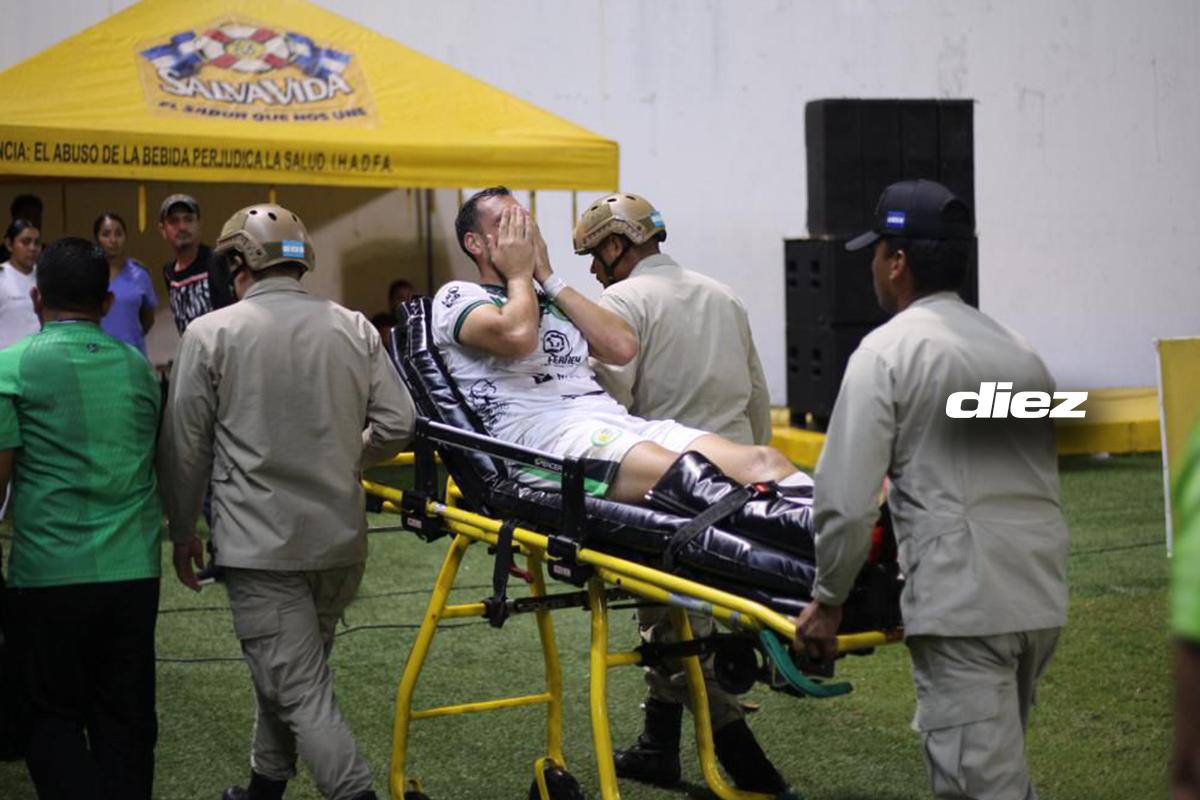 Fabricio Silva se fue lesionado con una fractura de tibia y peroné en el Real España-Juticalpa. (Foto por Mauricio Ayala)