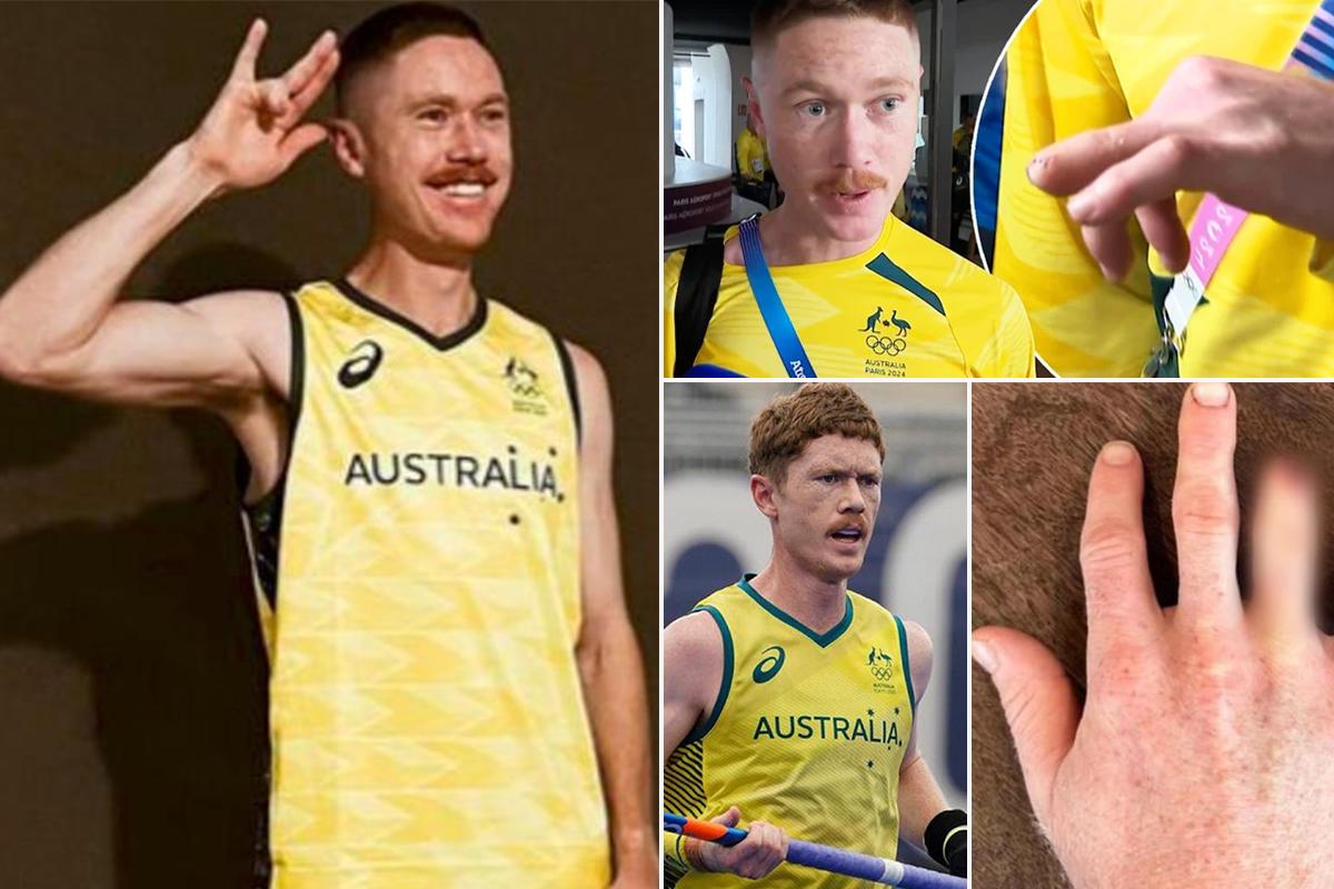 Se amputa un dedo para estar en los Juegos Olímpicos de París: “Tome la decisión, llamé a mi mujer y me dijo...”