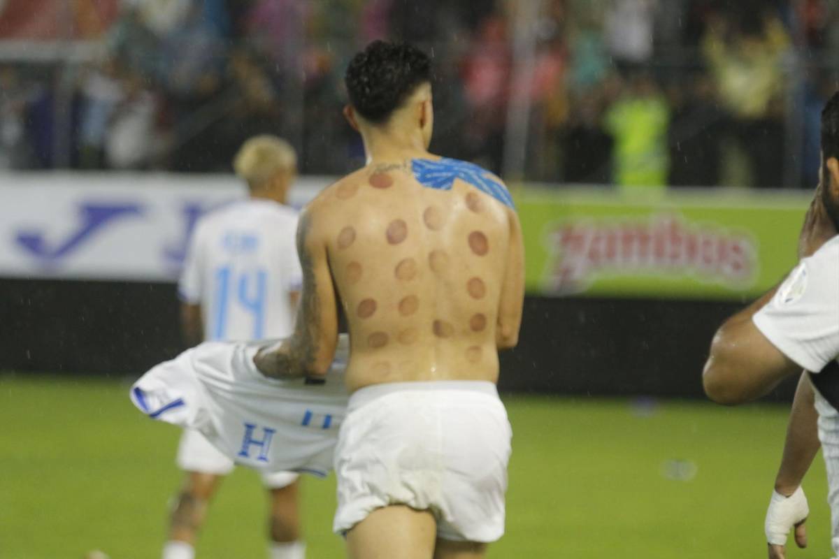 Luis Palma y su noche mágica contra la Selección Mexicana, la marca que impuso con Honduras ¿Por qué tiene moretones en su espalda?