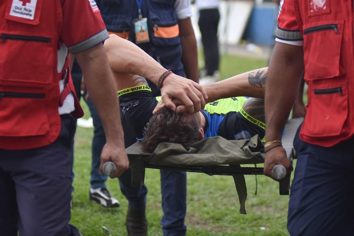 ¿Qué pasó antes del partido con los jugadores del Olancho? Los ‘pelados’ del Olimpia y lo que Auzmendi y Altamirano hacían en el gol de Omar Elvir