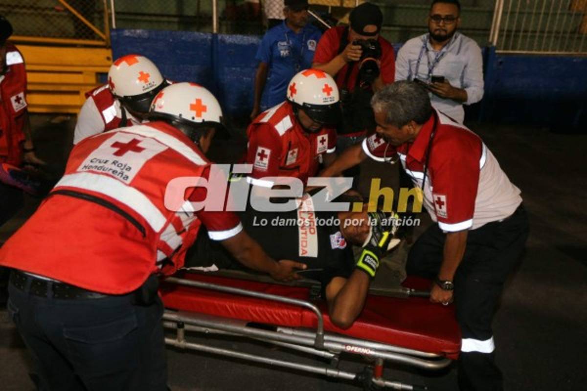 ¡QUÉ DRAMÁTICO! La espeluznante lesión de Donis Escober