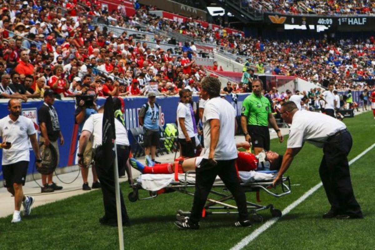 Facundo Ferreyra of Benficais is taken off the field after an injury against Juventus during their 2018 International Champions Cup at the Red Bull Arena on July 28, 2018, in Harrison, New Jersey. / AFP PHOTO / EDUARDO MUNOZ ALVAREZ