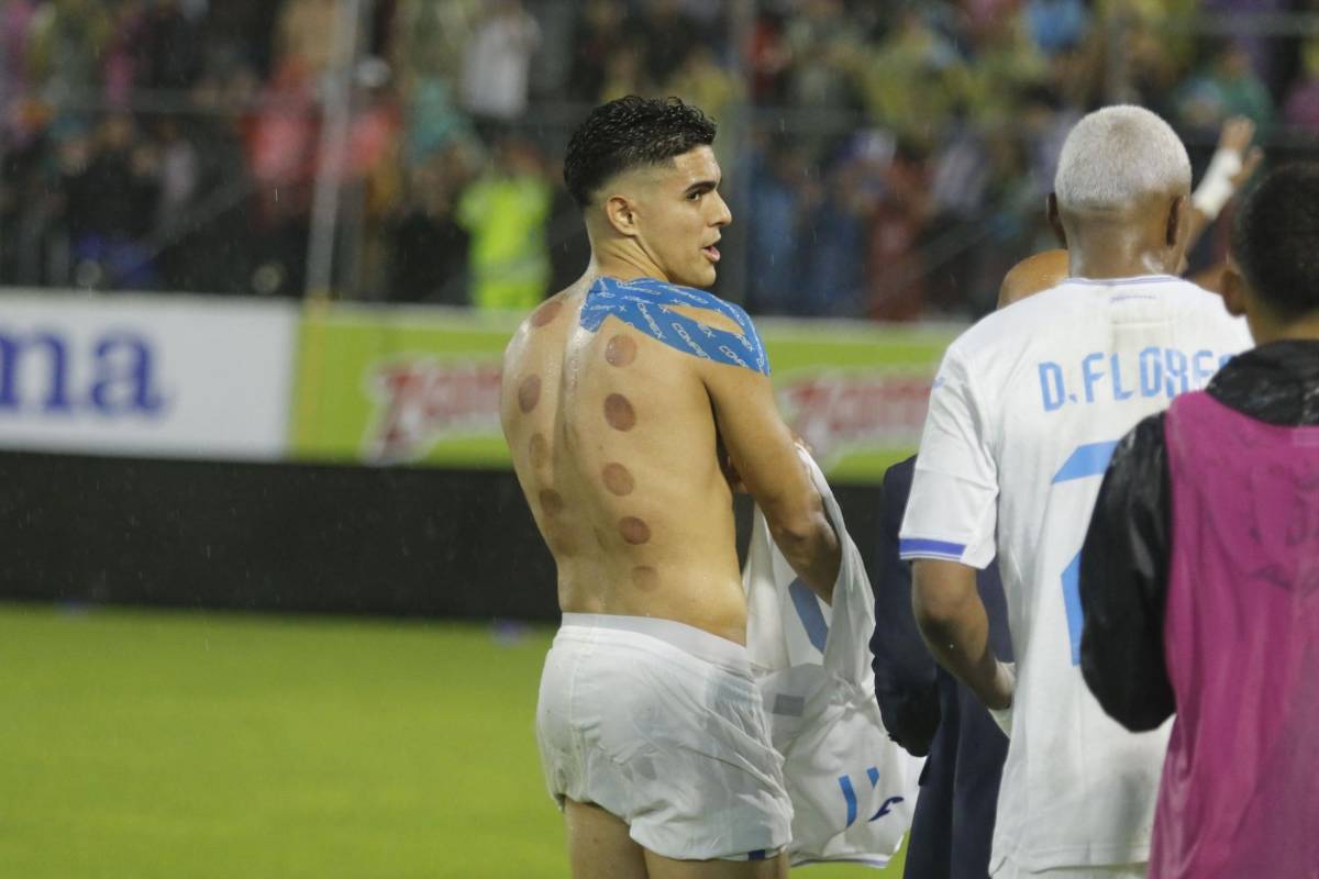 Luis Palma y su noche mágica contra la Selección Mexicana, la marca que impuso con Honduras ¿Por qué tiene moretones en su espalda?