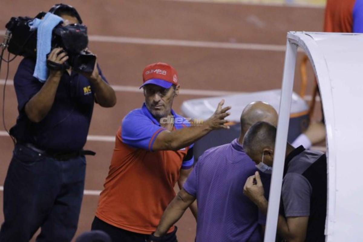 ¡Figura del Real España llegó con la mandíbula rota al Olímpico, las mejores fotos del Real España-Olimpia!