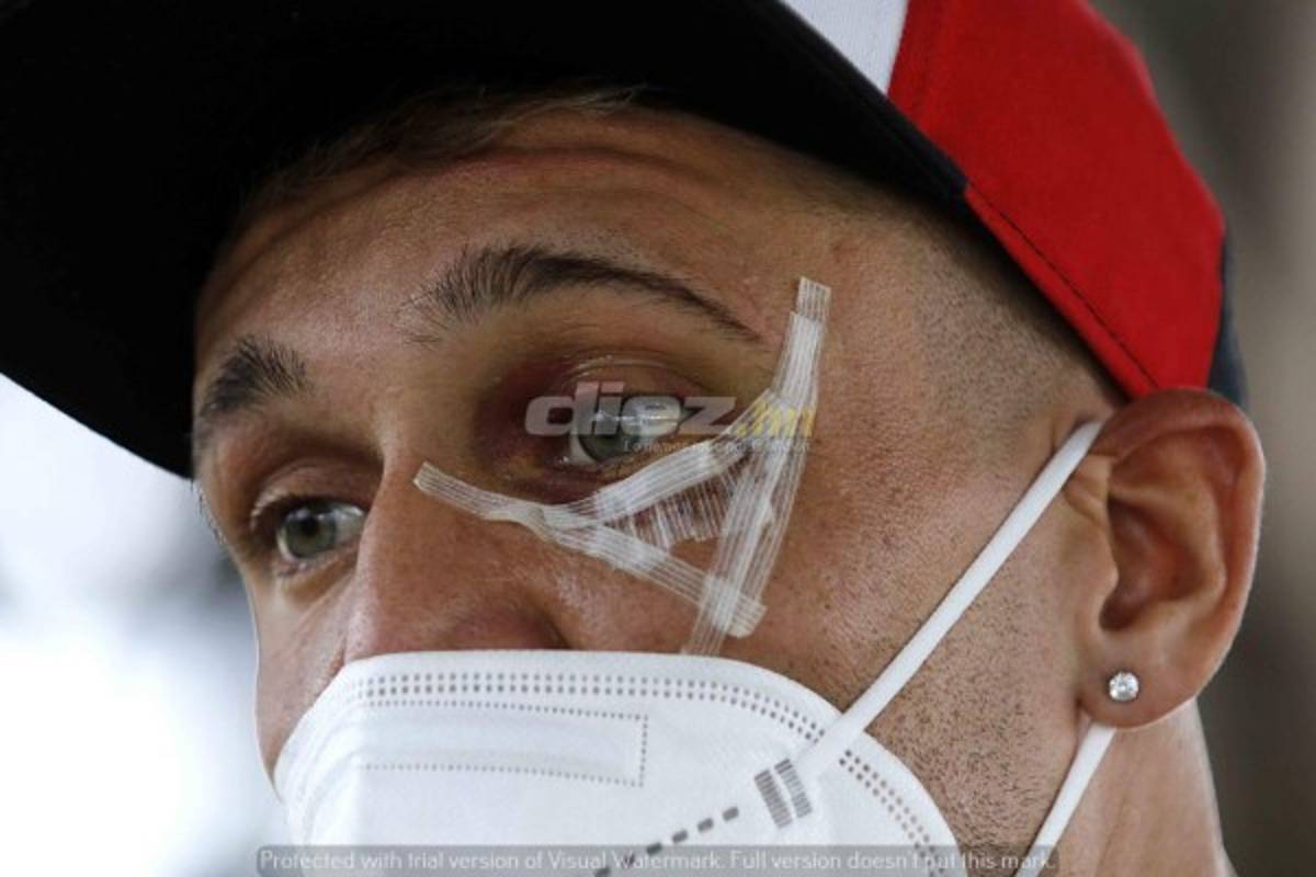 Pasó en Marathón: Techera con nueve puntos en su rostro, los consejos de Emilio a Vega y la charla de Vargas