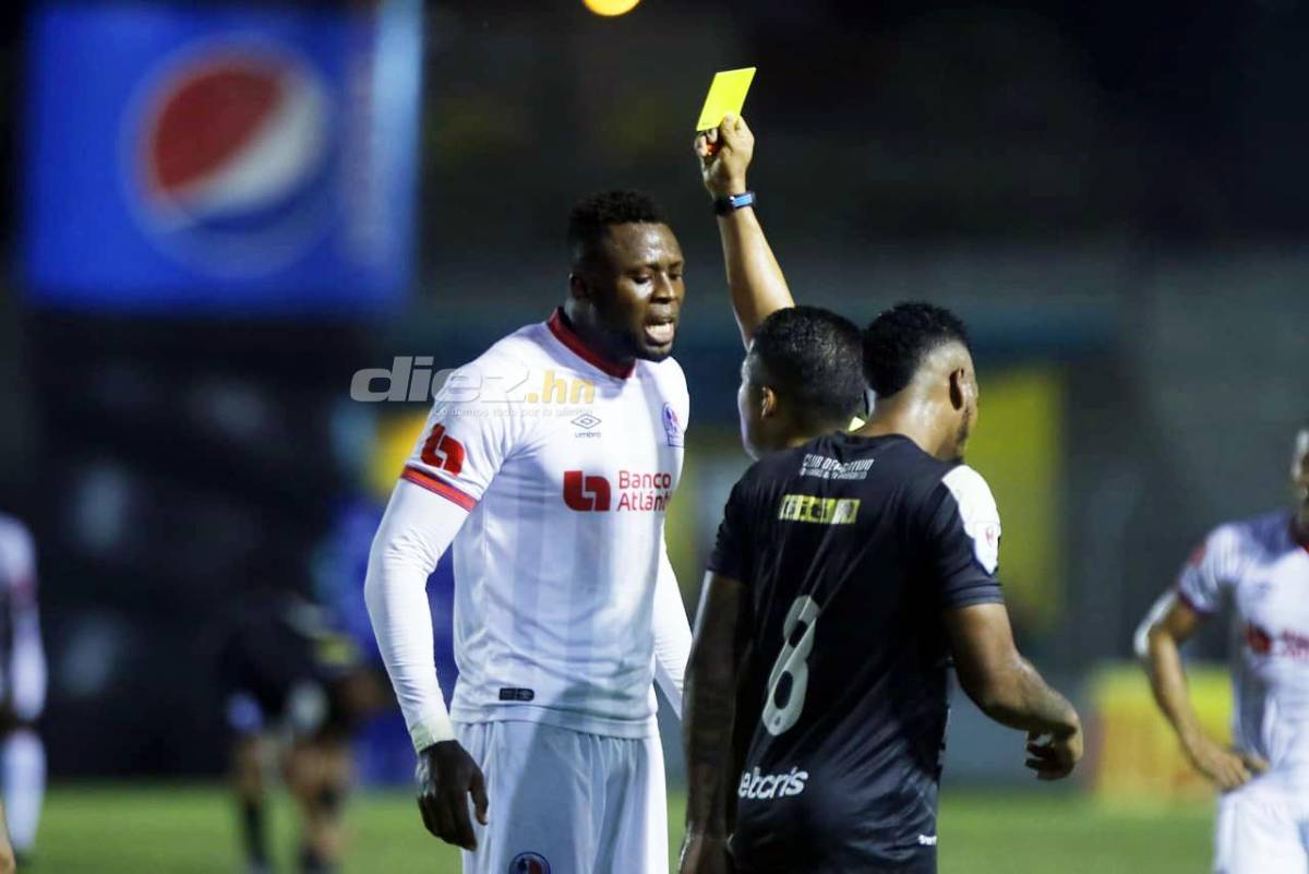 No se vio por TV: Lo que le lanzaron a Michaell Chirinos y se lo bebió, las bellezas en los estadios y la chica con la rosa