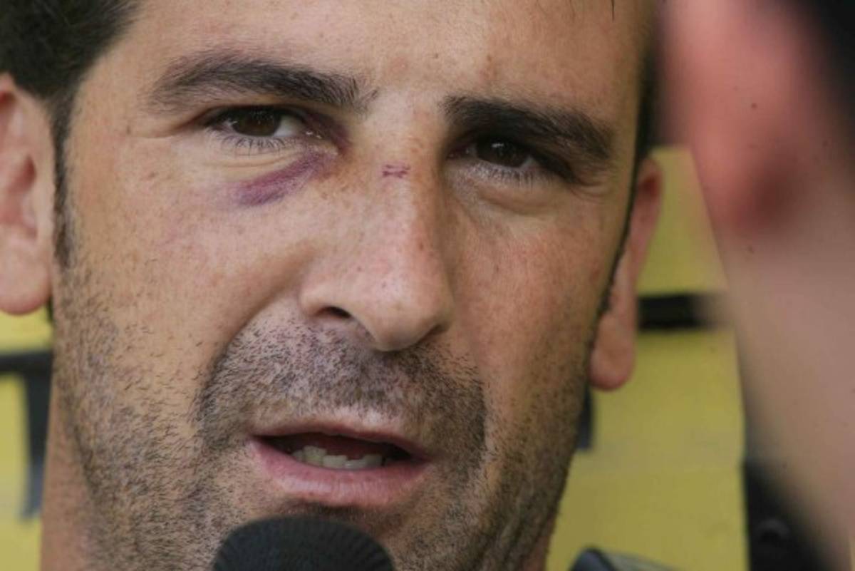 FOTOS: Los golpes y lesiones más brutales del fútbol hondureño