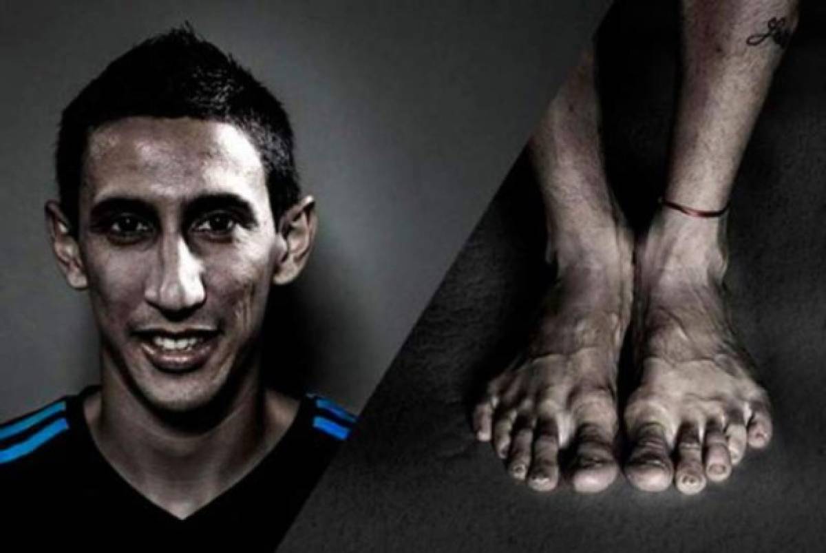 FOTOS: Así son los pies más feos de algunos deportistas reconocidos