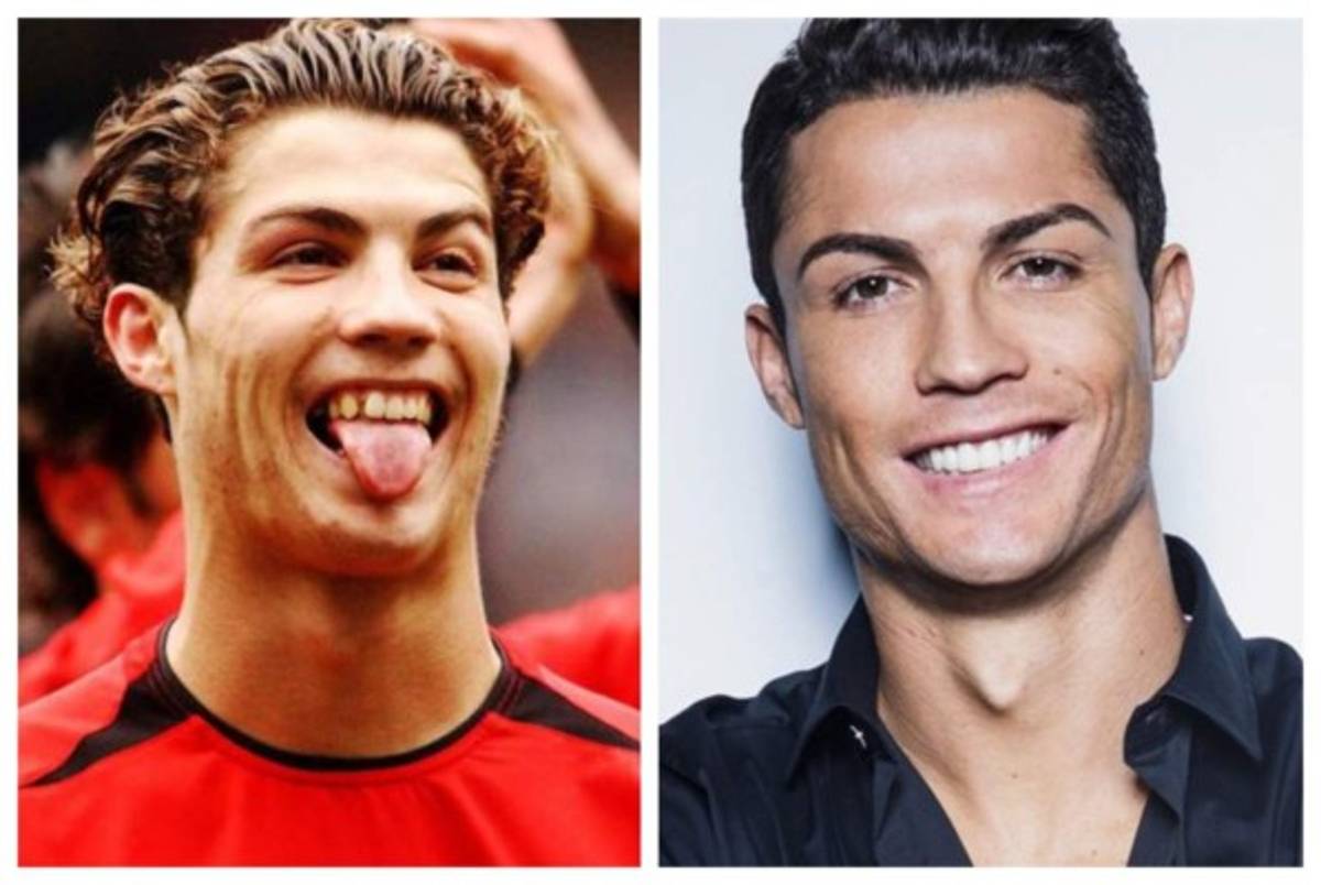 Cristiano Ronaldo el más llamativo: Deportistas famosos a los que el dentista les cambió la vida  