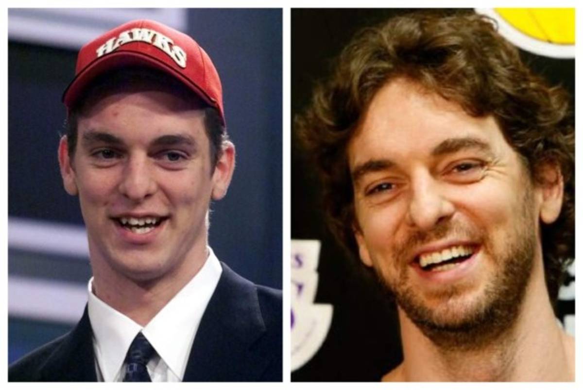 Cristiano Ronaldo el más llamativo: Deportistas famosos a los que el dentista les cambió la vida  