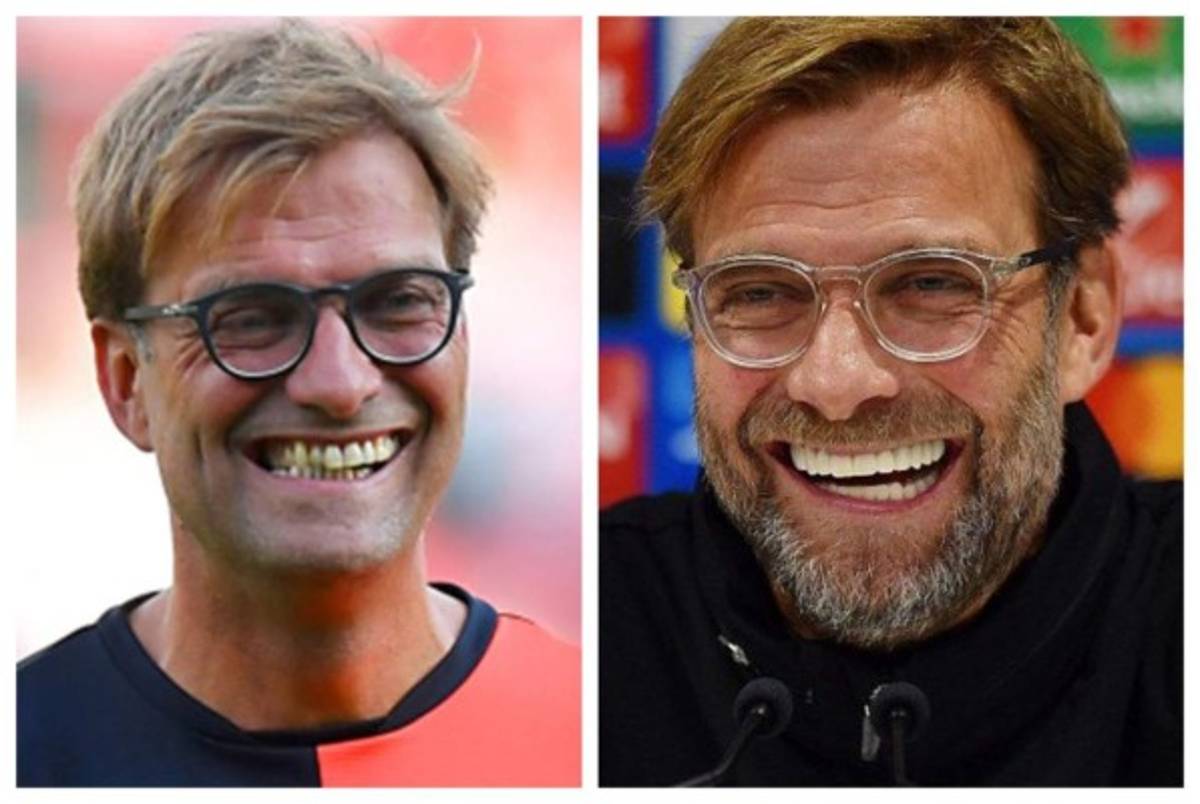 Cristiano Ronaldo el más llamativo: Deportistas famosos a los que el dentista les cambió la vida  