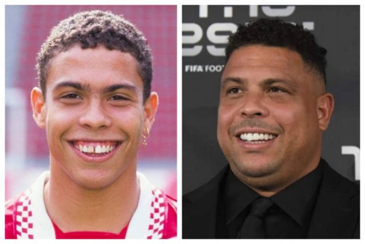 Cristiano Ronaldo el más llamativo: Deportistas famosos a los que el dentista les cambió la vida  