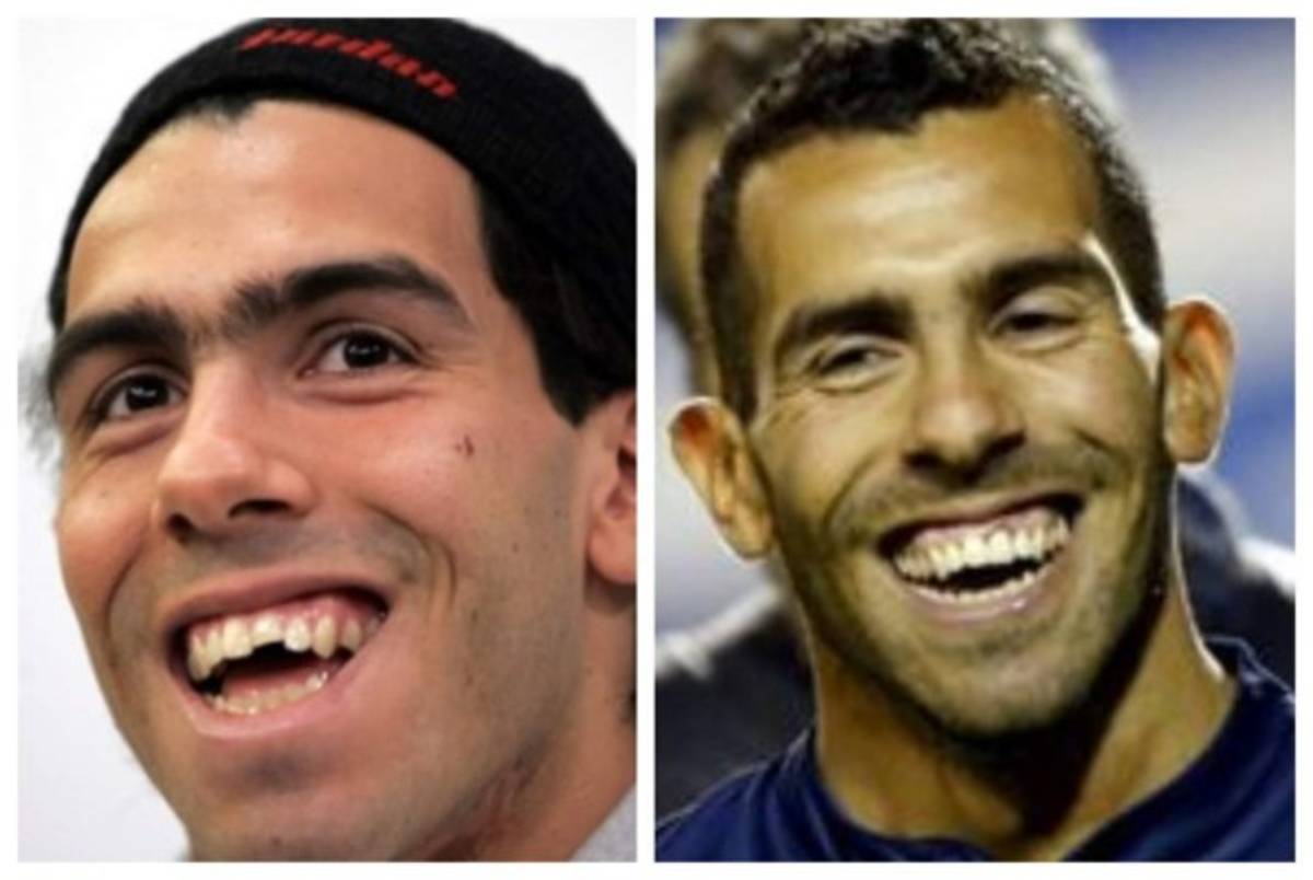 Cristiano Ronaldo el más llamativo: Deportistas famosos a los que el dentista les cambió la vida  