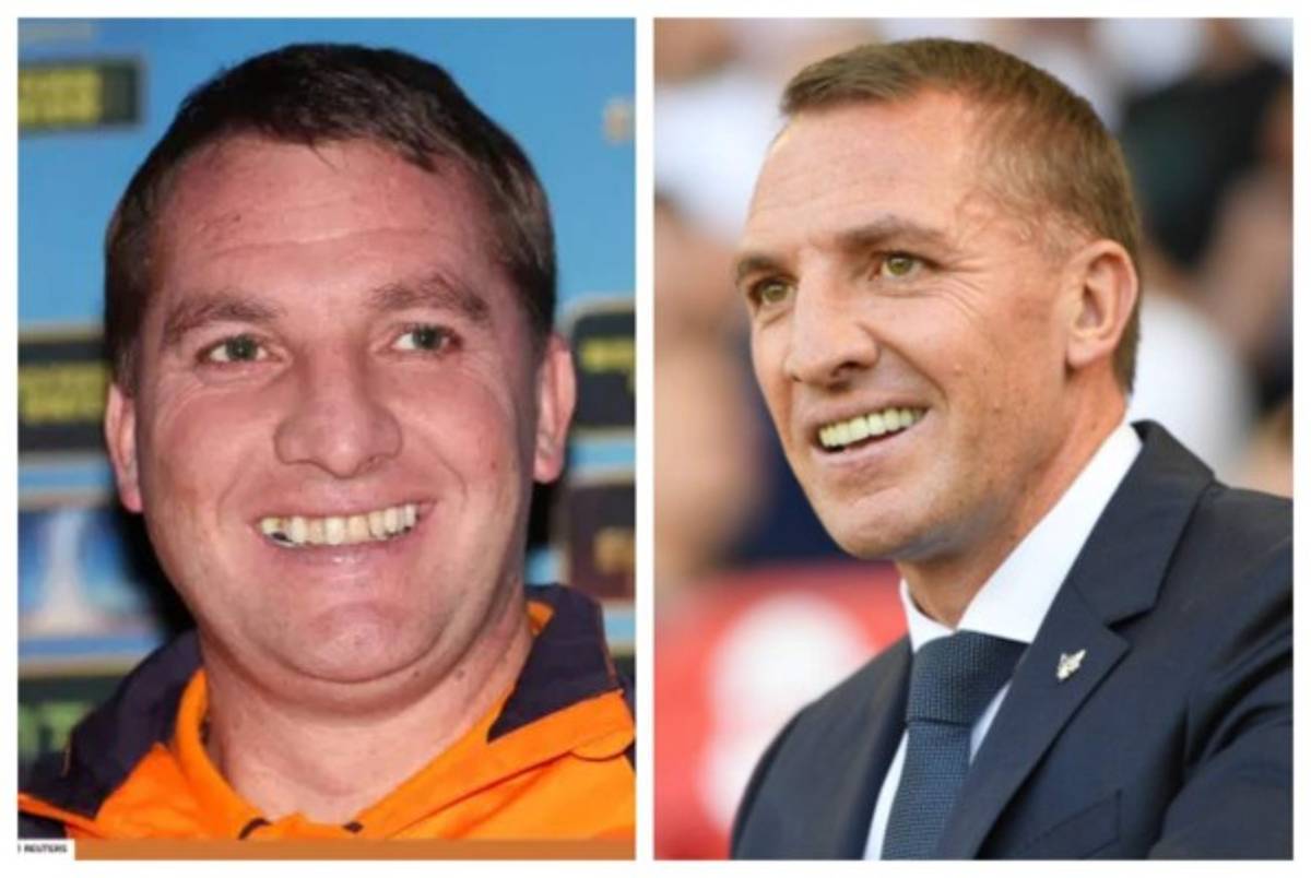 Cristiano Ronaldo el más llamativo: Deportistas famosos a los que el dentista les cambió la vida  