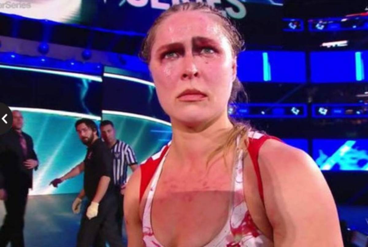 Moretones y heridas: Las fotos actualizadas de cómo quedó Ronda Rousey una semana depués de la paliza