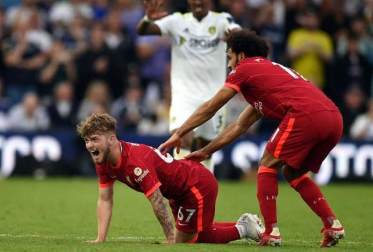 No apto para sensibles: Así fue la escalofriante lesión de Harvey Elliott del Liverpool; sufrimiento y shock de Klopp  