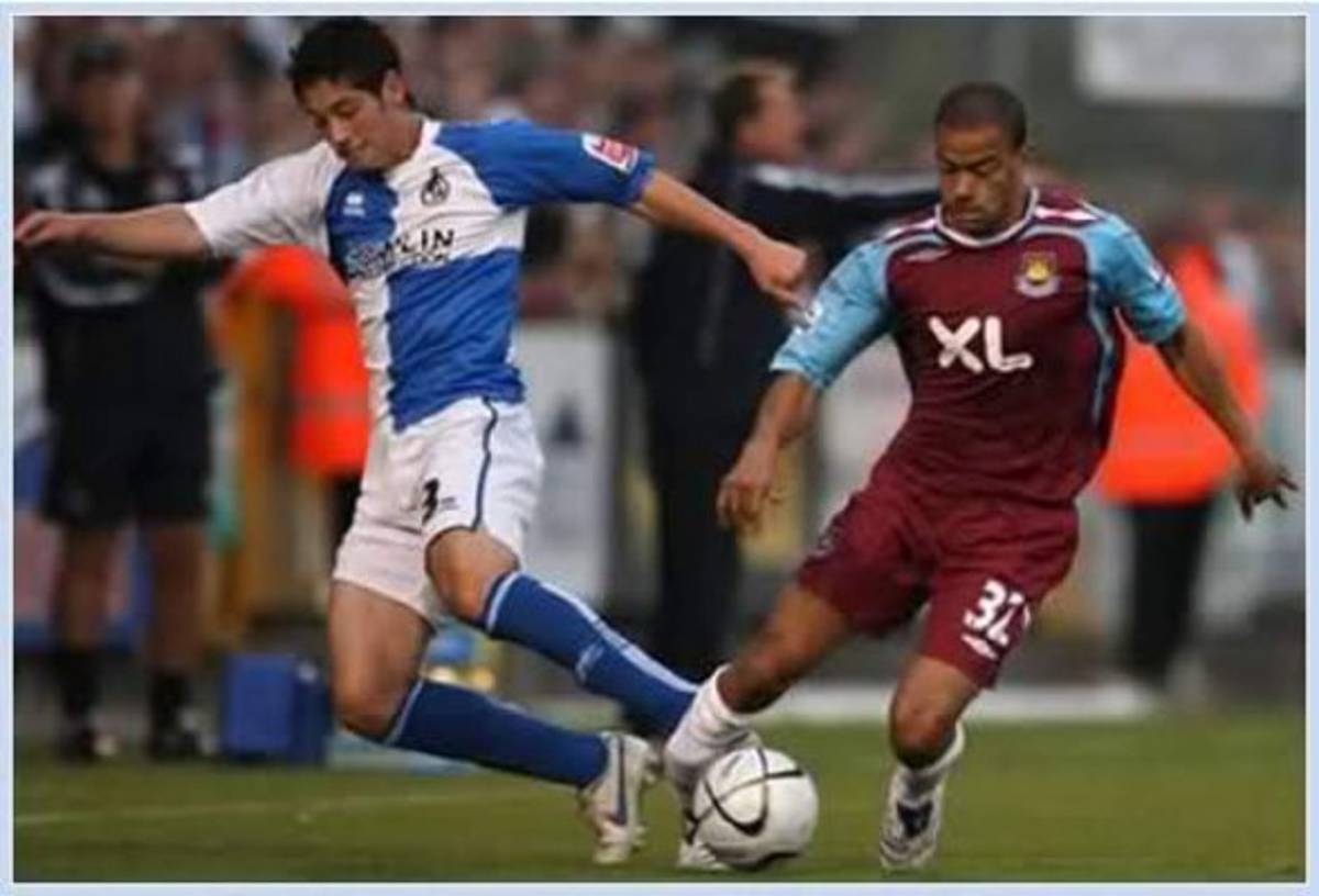 Estas son las lesiones más terribles en la historia del fútbol