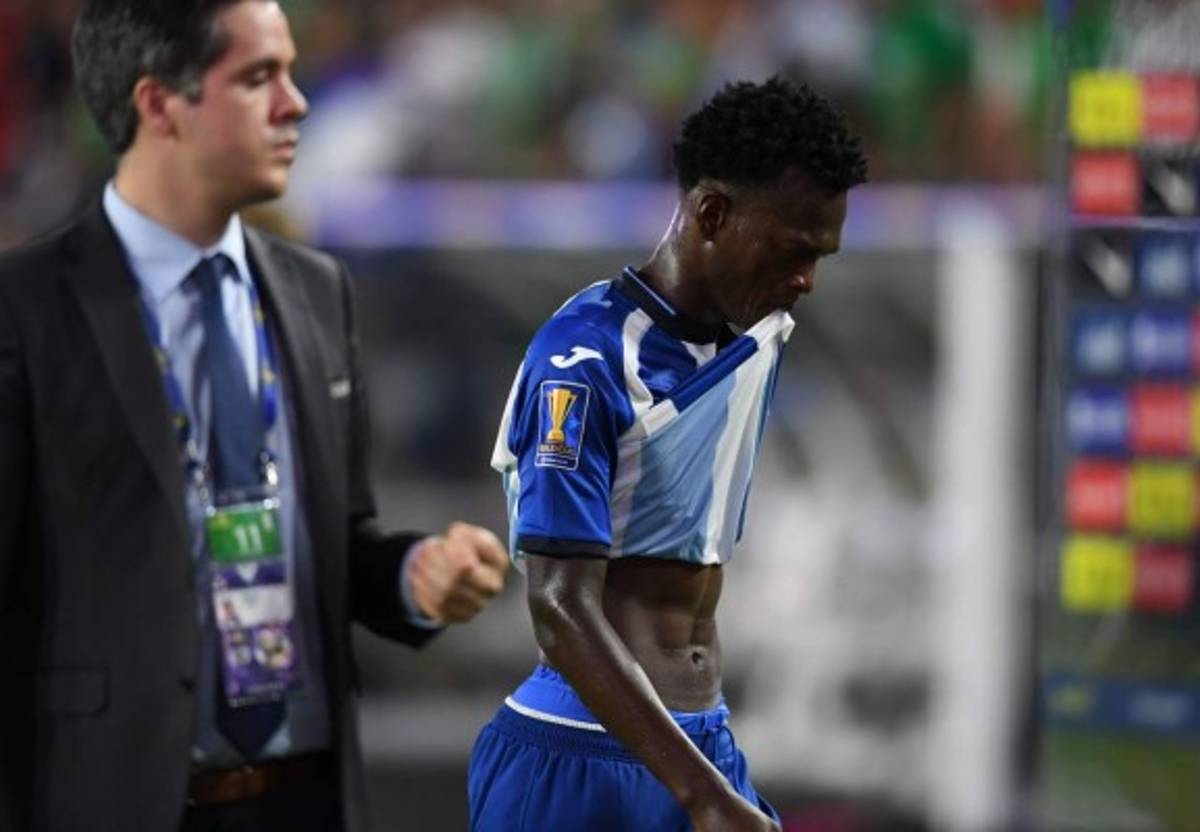 LO QUE NO SE VIO: El barbón, el espontáneo y el sufrimiento de Honduras