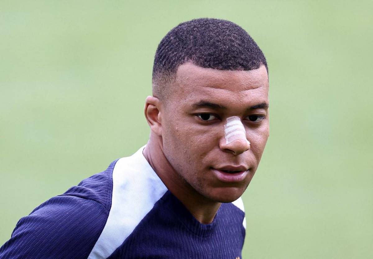 Las primeras fotos de Kylian Mbappé tras fracturarse la nariz en la Eurocopa 2024: el anuncio de su entrenador