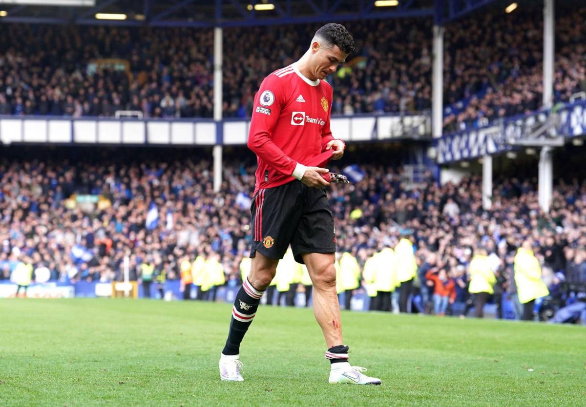 Escalofriante: así le quedó la pierna a Cristiano Ronaldo en la dolorosa derrota del Manchester United