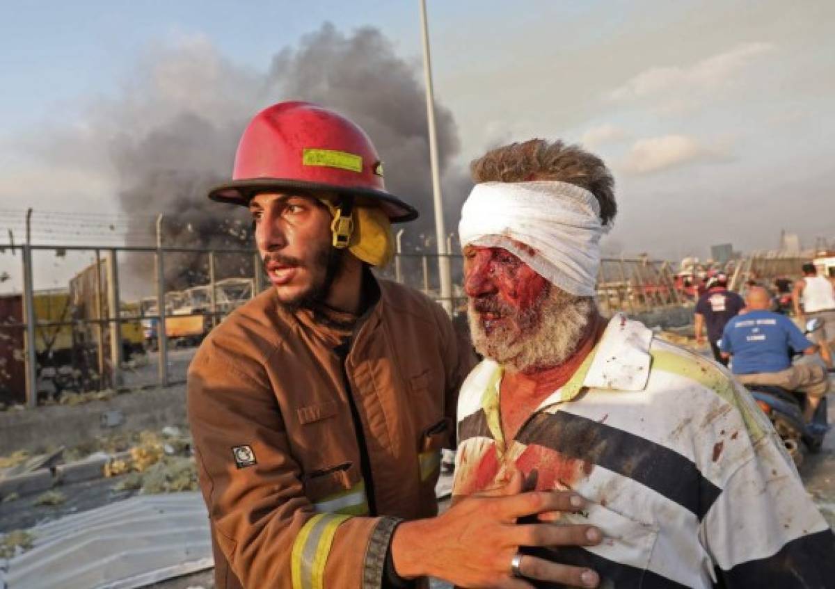 Catastrófico: La terrible explosión en Beirut, Líbano, que deja decenas de muertos