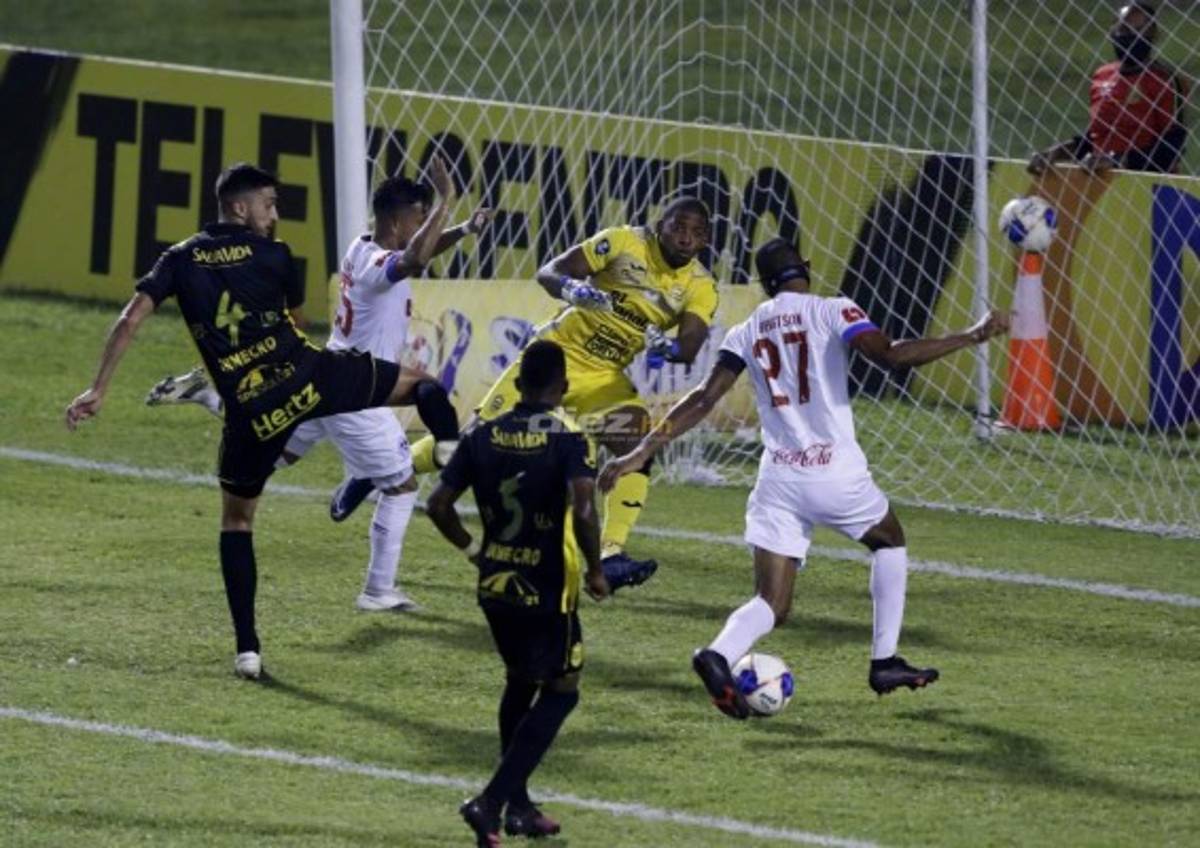 ¡Figura del Real España llegó con la mandíbula rota al Olímpico, las mejores fotos del Real España-Olimpia!