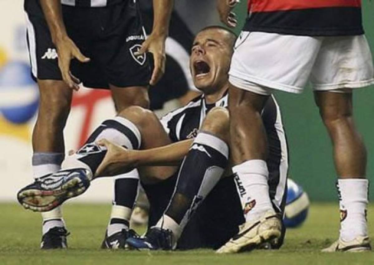 ¡De terror! Las lesiones más escalofriantes que se han visto en el mundo del fútbol