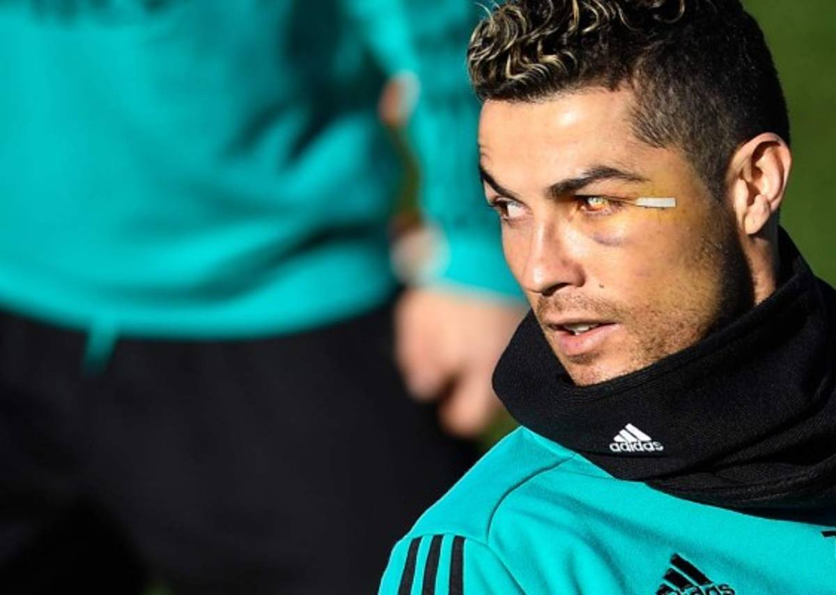 ¡NO SE VIO EN TV! Dedazo de CR7, la broma de Zidane y la caída de Marcelo